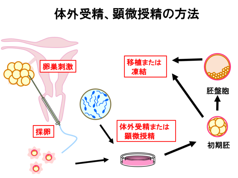 Q. 人工授精は、体外受精とどう違いますか? | 医療法人社団栄賢会梅ヶ丘産婦人科