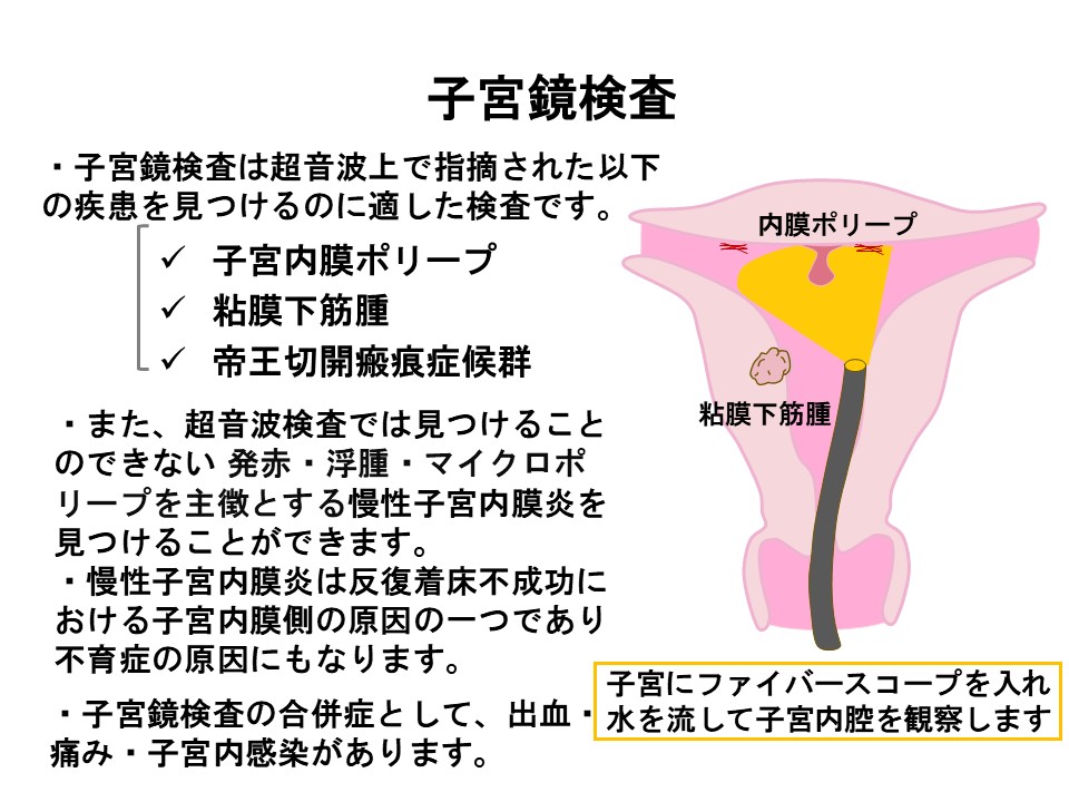 子宮鏡検査