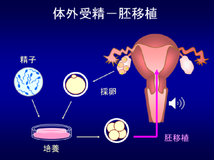 体外受精 顕微授精 梅ヶ丘産婦人科