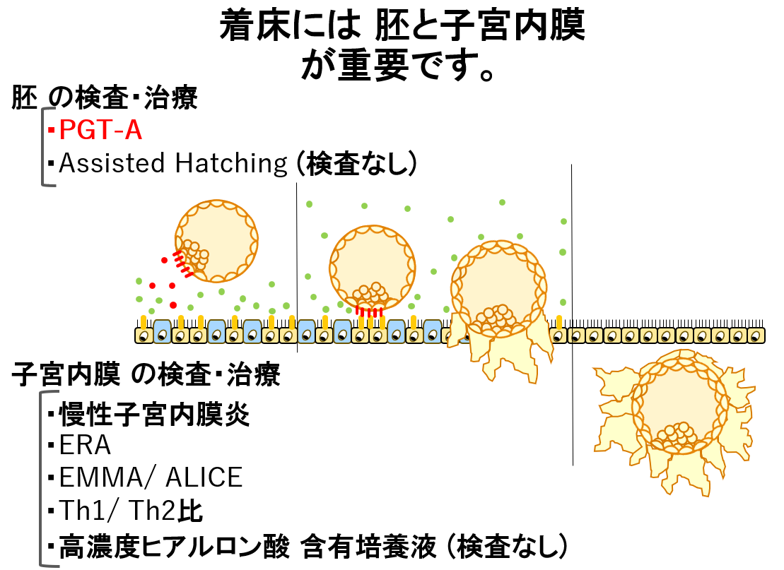 反復着床不成功／着床前遺伝学的検査（PGT-A /PGT-SR）