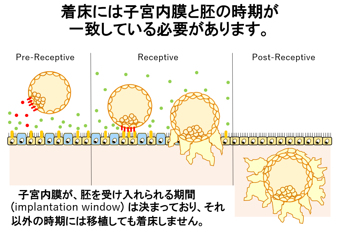 子宮内膜受容能検査（ERA）