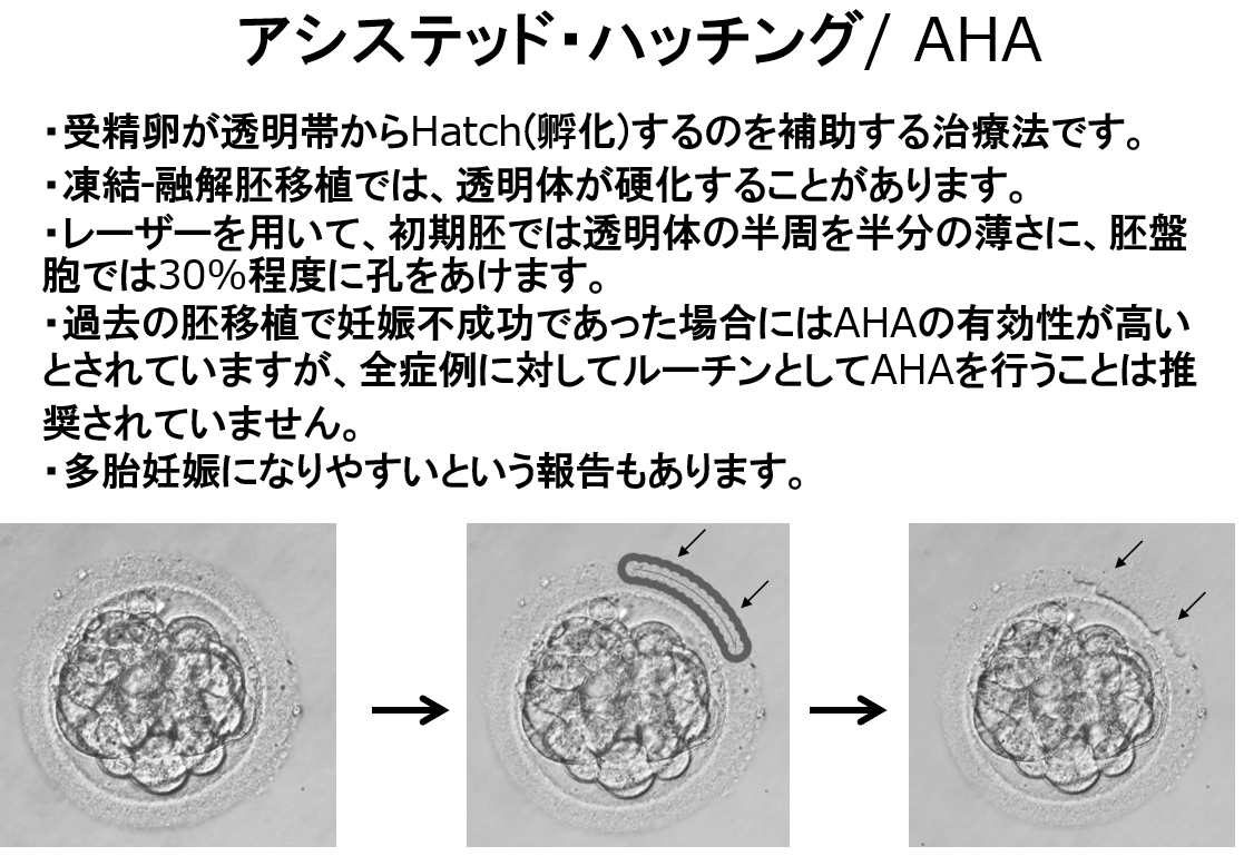 アシステッド・ハッチング(AHA)