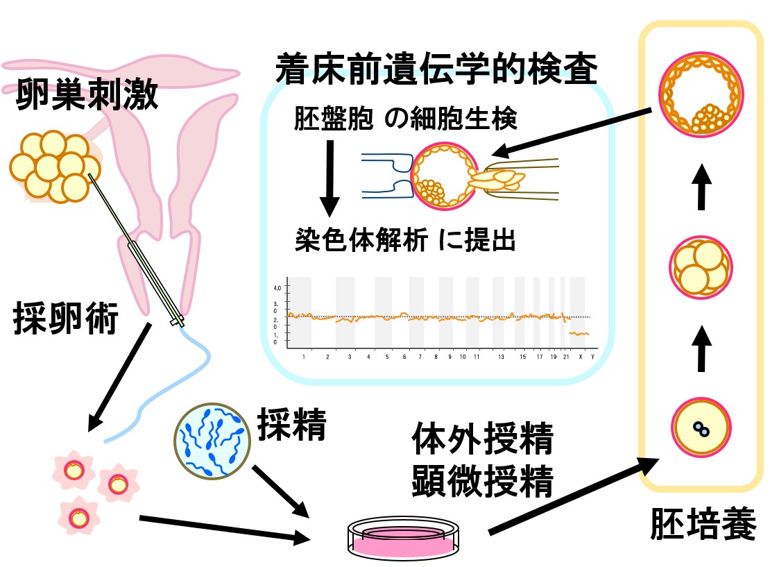 着床前遺伝学的検査（PGT-A /PGT-SR）