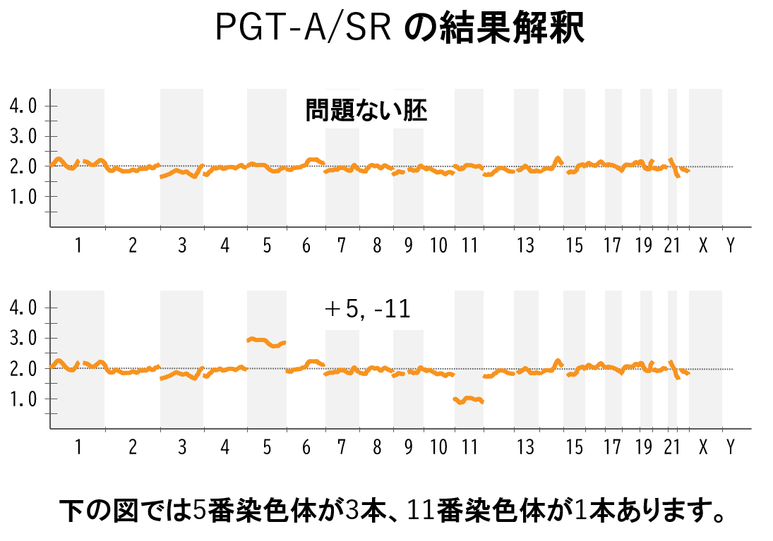 着床前遺伝学的検査（PGT-A /PGT-SR）